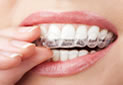 tooth whitening